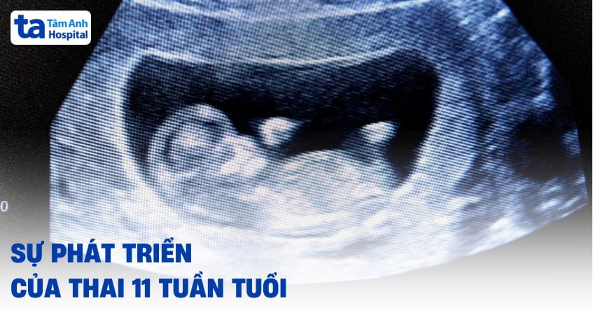 Thai nhi 11 tuần tuổi phát triển như thế nào? Đã bám chắc chưa?